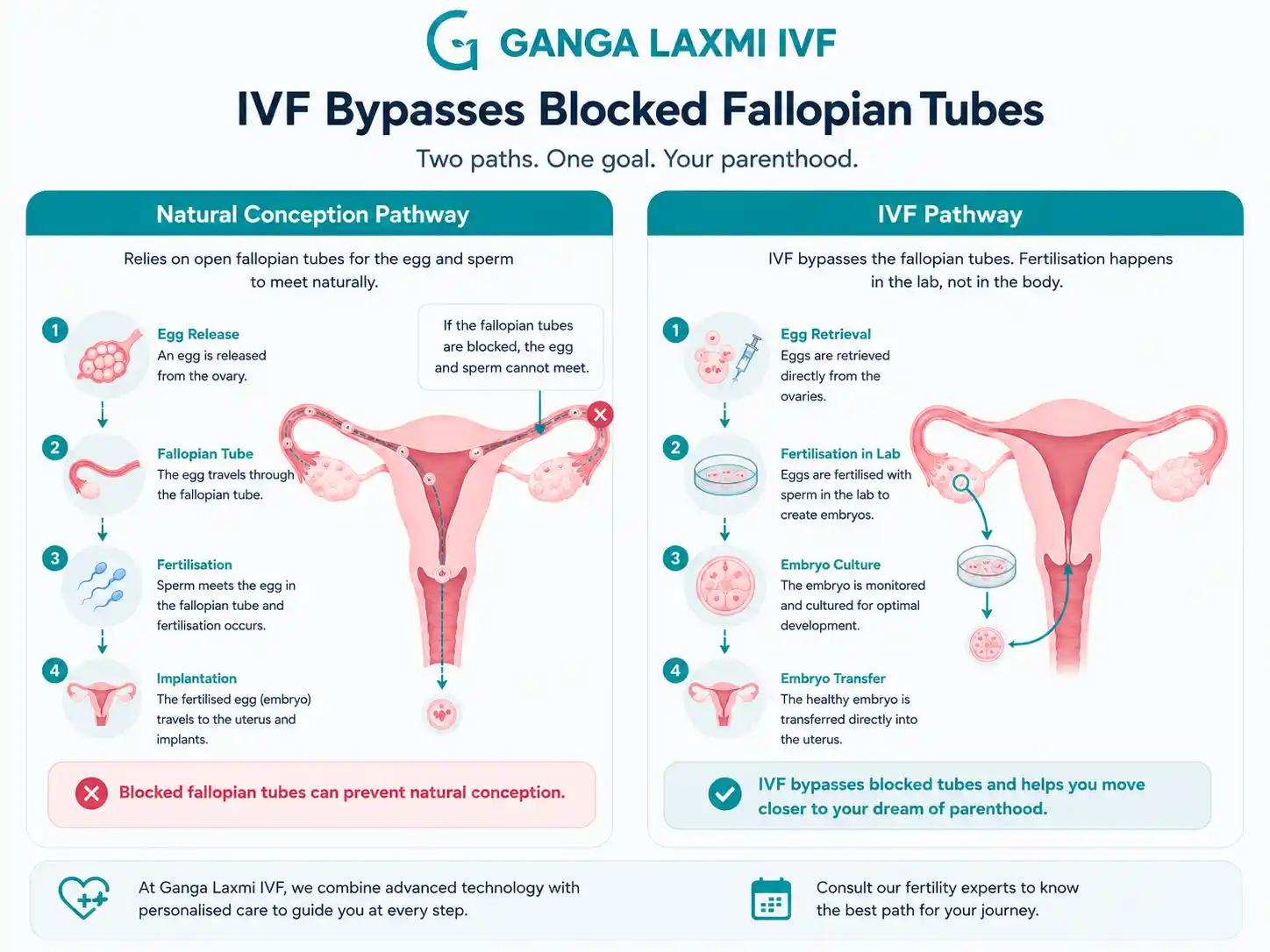 Infographic comparing natural conception and IVF pathways when fallopian tubes are blocked